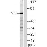 Western blot - p63 Antibody from Signalway Antibody (33462) - Antibodies.com