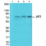 Western blot - p63 Antibody from Signalway Antibody (33462) - Antibodies.com