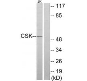 Western blot - CSK Antibody from Signalway Antibody (33766) - Antibodies.com