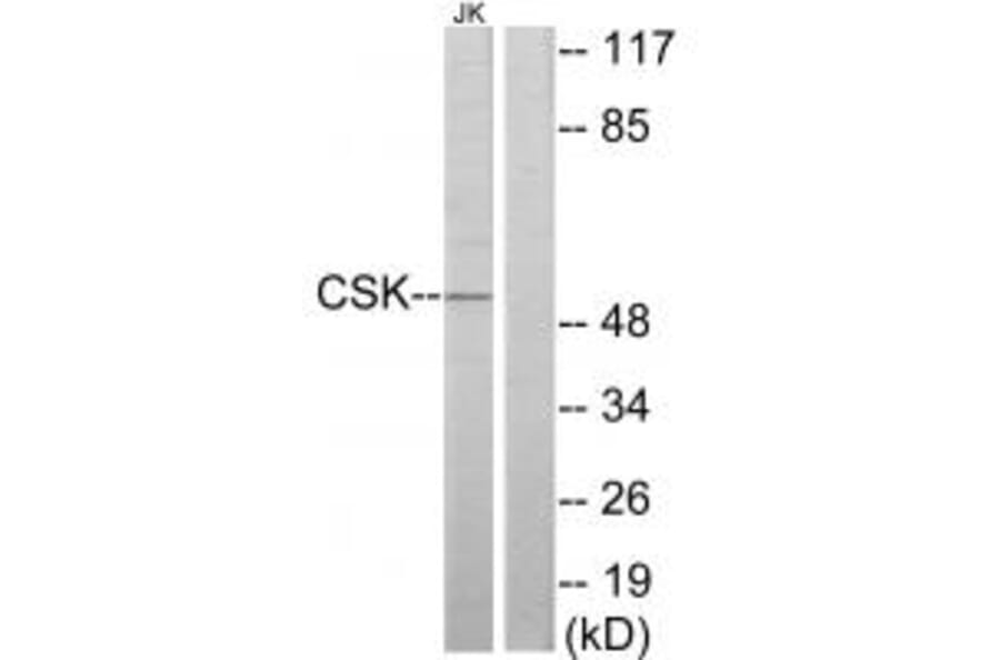 Western blot - CSK Antibody from Signalway Antibody (33766) - Antibodies.com