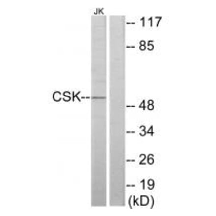 Western blot - CSK Antibody from Signalway Antibody (33766) - Antibodies.com