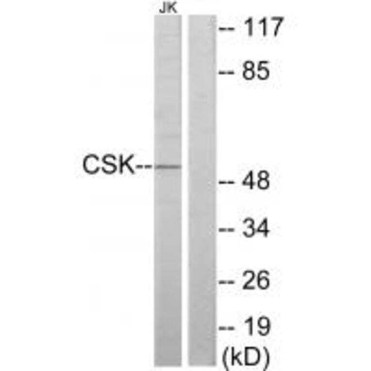 Western blot - CSK Antibody from Signalway Antibody (33766) - Antibodies.com