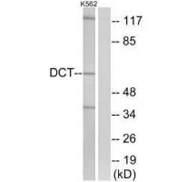 Western blot - DCT Antibody from Signalway Antibody (34754) - Antibodies.com