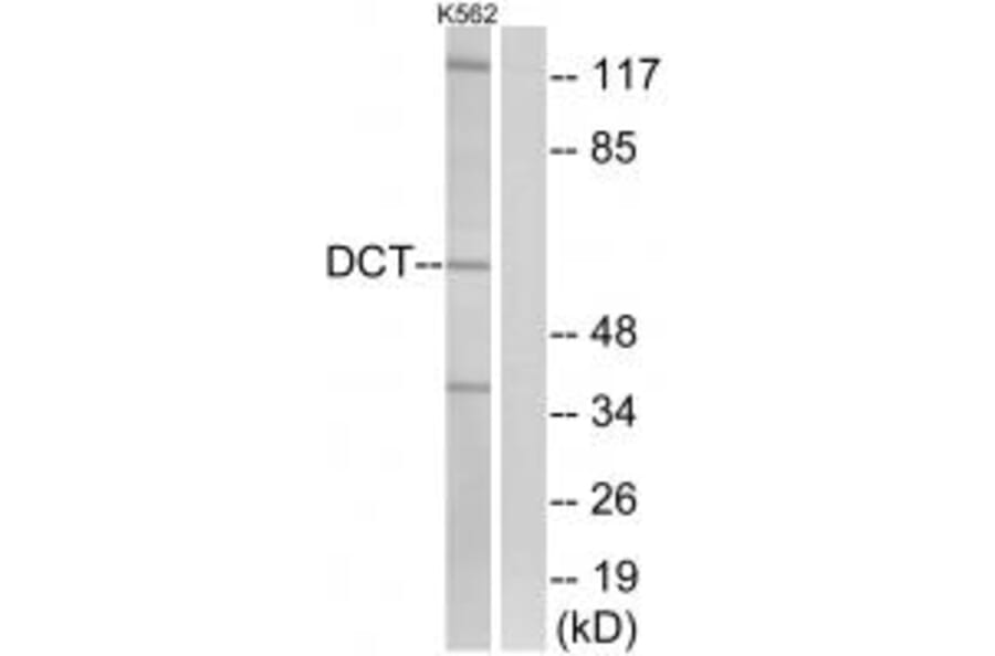 Western blot - DCT Antibody from Signalway Antibody (34754) - Antibodies.com