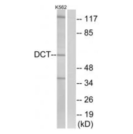 Western blot - DCT Antibody from Signalway Antibody (34754) - Antibodies.com