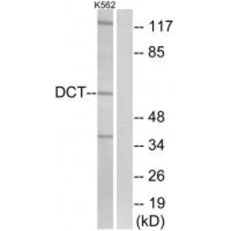 Western blot - DCT Antibody from Signalway Antibody (34754) - Antibodies.com