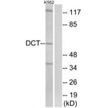 Western blot - DCT Antibody from Signalway Antibody (34754) - Antibodies.com