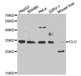 Western blot - CLU antibody from Signalway Antibody (38241) - Antibodies.com
