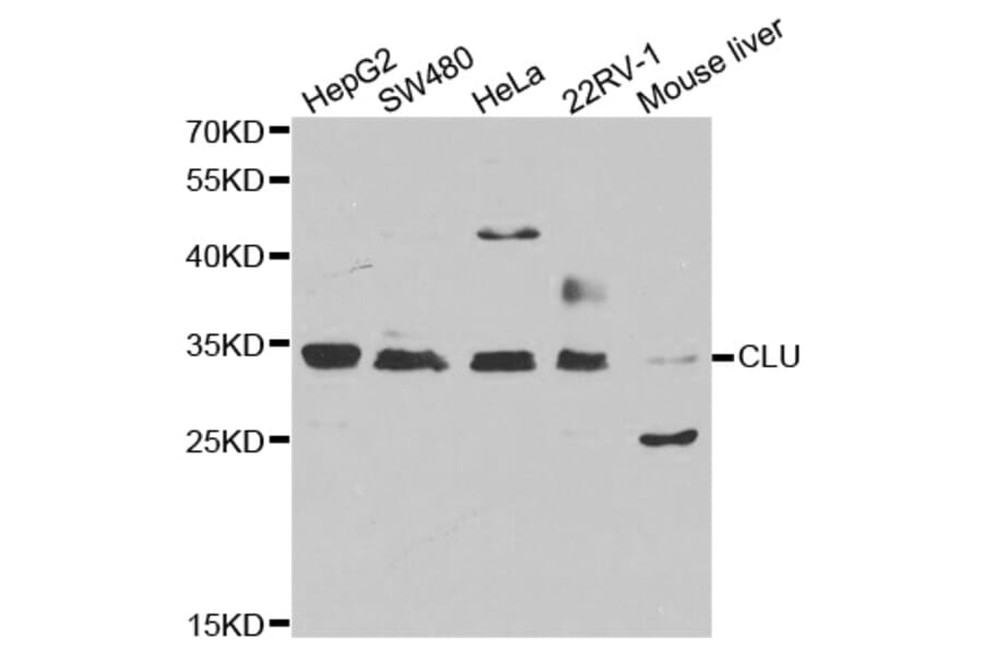Western blot - CLU antibody from Signalway Antibody (38241) - Antibodies.com