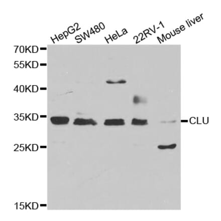 Western blot - CLU antibody from Signalway Antibody (38241) - Antibodies.com