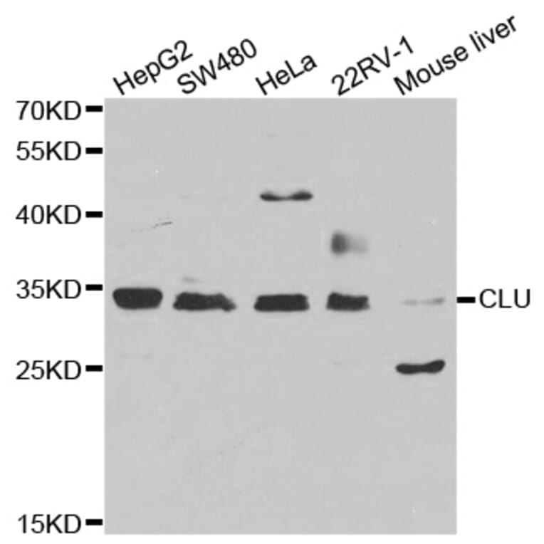 Western blot - CLU antibody from Signalway Antibody (38241) - Antibodies.com