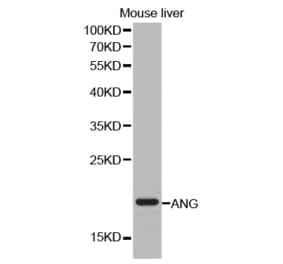 Western blot - ANG antibody from Signalway Antibody (38249) - Antibodies.com