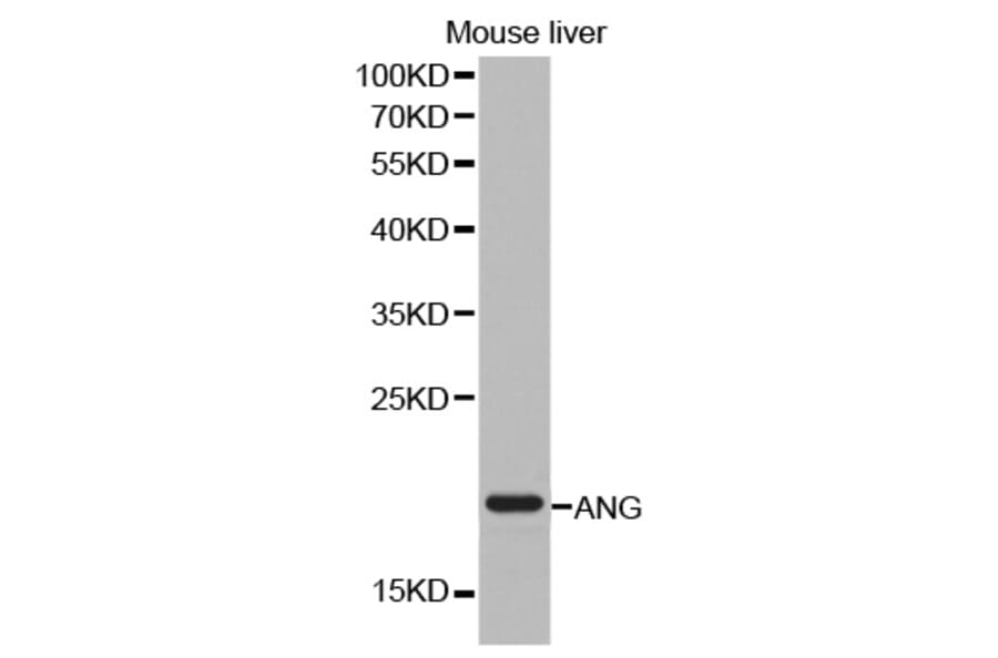 Western blot - ANG antibody from Signalway Antibody (38249) - Antibodies.com
