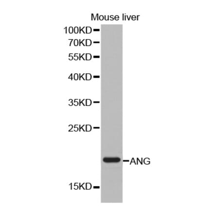 Western blot - ANG antibody from Signalway Antibody (38249) - Antibodies.com