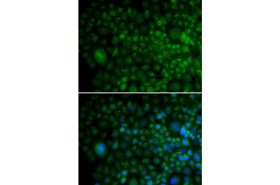 Immunofluorescence - ANG antibody from Signalway Antibody (38249) - Antibodies.com