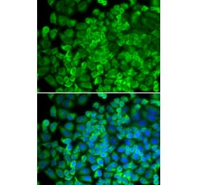 Immunofluorescence - GLA antibody from Signalway Antibody (38284) - Antibodies.com