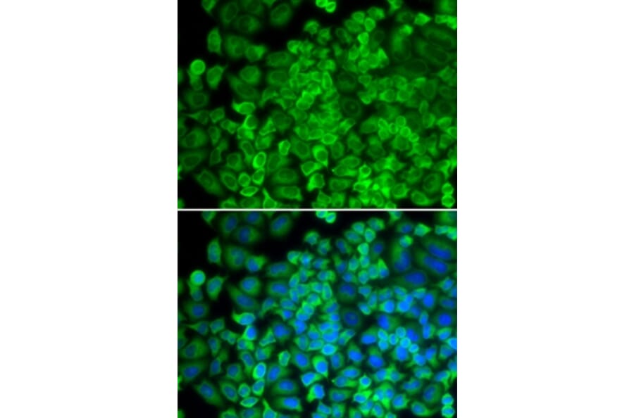 Immunofluorescence - GLA antibody from Signalway Antibody (38284) - Antibodies.com