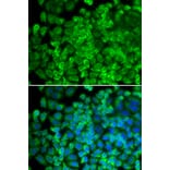 Immunofluorescence - GLA antibody from Signalway Antibody (38284) - Antibodies.com