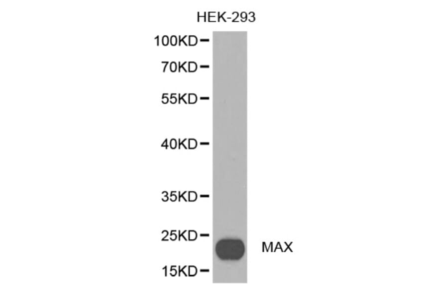 Western blot - MAX antibody from Signalway Antibody (38388) - Antibodies.com