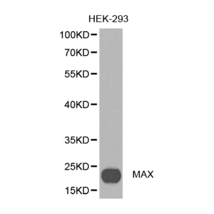 Western blot - MAX antibody from Signalway Antibody (38388) - Antibodies.com