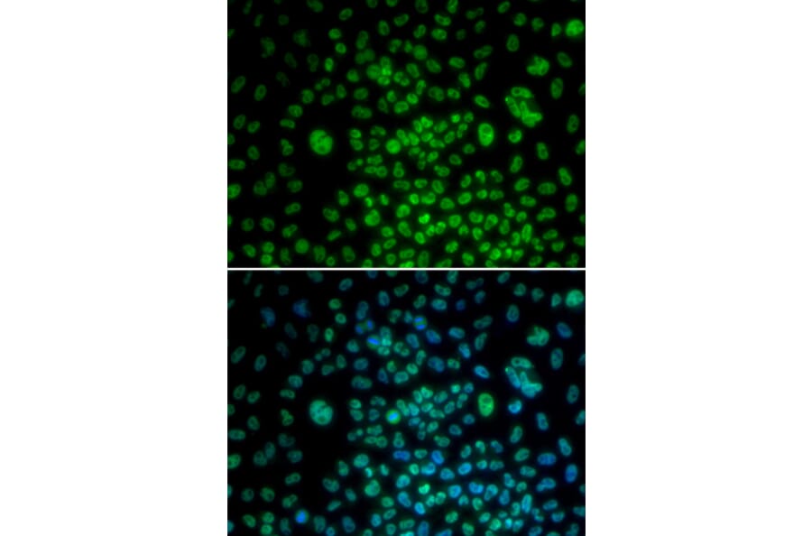 Immunofluorescence - MAX antibody from Signalway Antibody (38388) - Antibodies.com