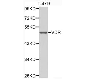 Western blot - VDR antibody from Signalway Antibody (38397) - Antibodies.com