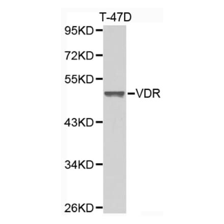 Western blot - VDR antibody from Signalway Antibody (38397) - Antibodies.com