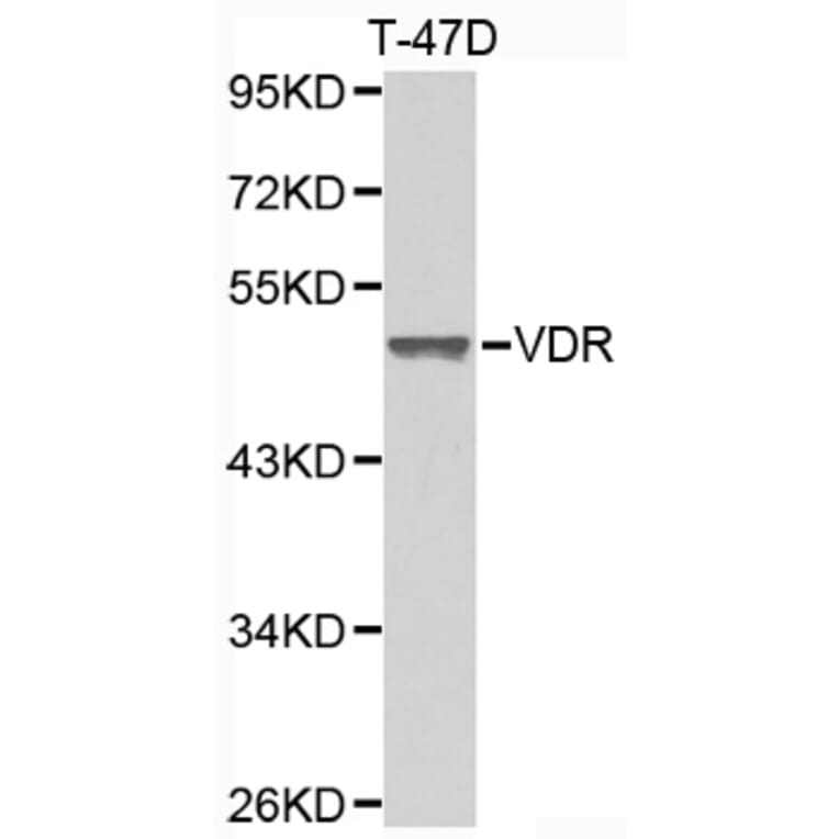 Western blot - VDR antibody from Signalway Antibody (38397) - Antibodies.com