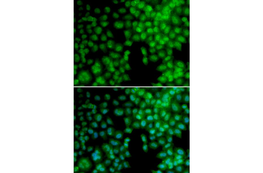 Immunofluorescence - VDR antibody from Signalway Antibody (38397) - Antibodies.com