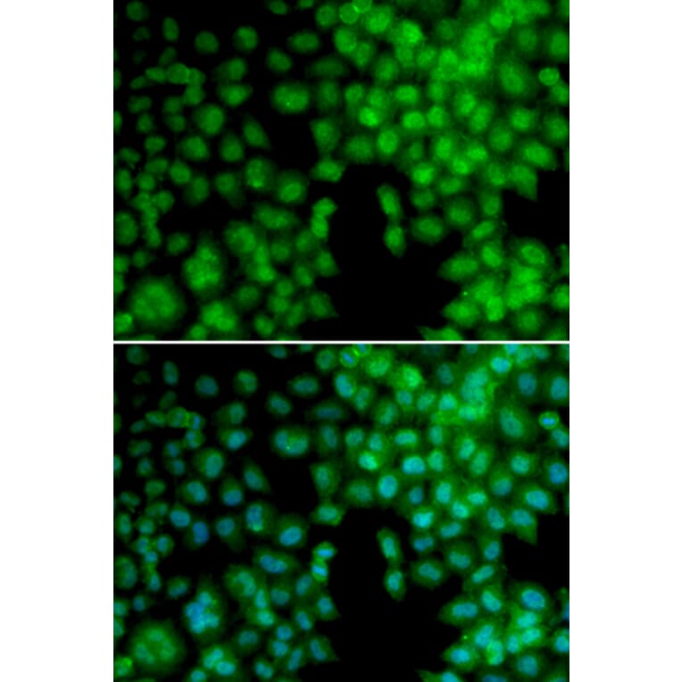 Immunofluorescence - VDR antibody from Signalway Antibody (38397) - Antibodies.com