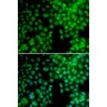 Immunofluorescence - VDR antibody from Signalway Antibody (38397) - Antibodies.com