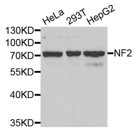 Western blot - NF2 antibody from Signalway Antibody (38403) - Antibodies.com