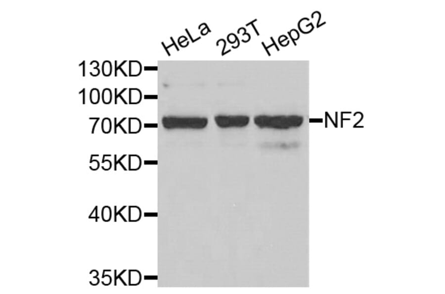 Western blot - NF2 antibody from Signalway Antibody (38403) - Antibodies.com