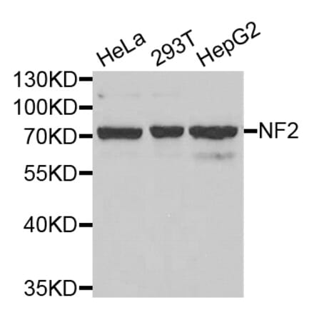Western blot - NF2 antibody from Signalway Antibody (38403) - Antibodies.com