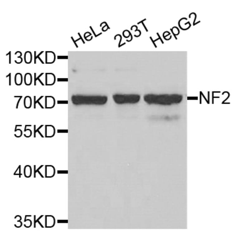 Western blot - NF2 antibody from Signalway Antibody (38403) - Antibodies.com