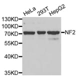 Western blot - NF2 antibody from Signalway Antibody (38403) - Antibodies.com