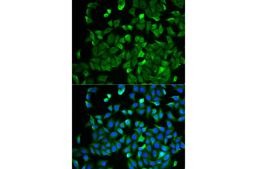 Immunofluorescence - NF2 antibody from Signalway Antibody (38403) - Antibodies.com