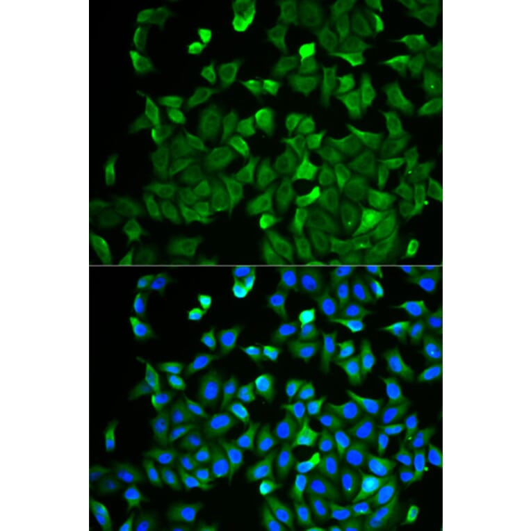Immunofluorescence - NF2 antibody from Signalway Antibody (38403) - Antibodies.com