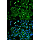 Immunofluorescence - NF2 antibody from Signalway Antibody (38403) - Antibodies.com