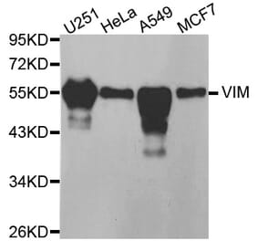 Western blot - VIM antibody from Signalway Antibody (38436) - Antibodies.com