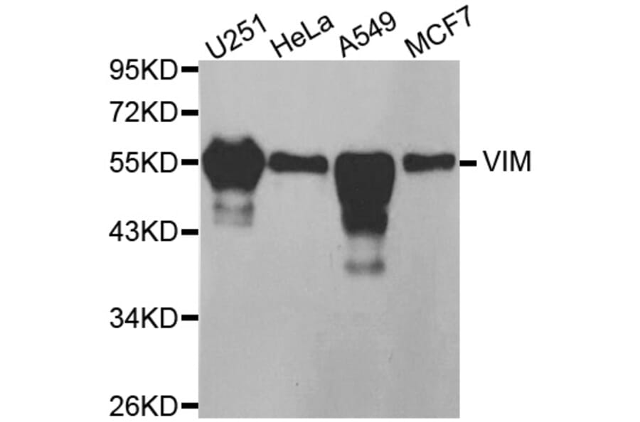 Western blot - VIM antibody from Signalway Antibody (38436) - Antibodies.com