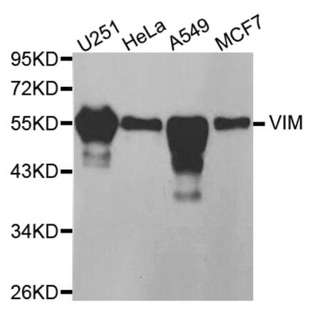 Western blot - VIM antibody from Signalway Antibody (38436) - Antibodies.com