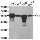 Western blot - VIM antibody from Signalway Antibody (38436) - Antibodies.com