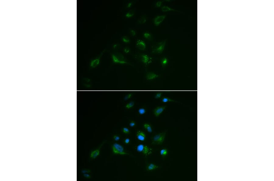 Immunofluorescence - VIM antibody from Signalway Antibody (38436) - Antibodies.com