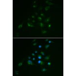 Immunofluorescence - VIM antibody from Signalway Antibody (38436) - Antibodies.com
