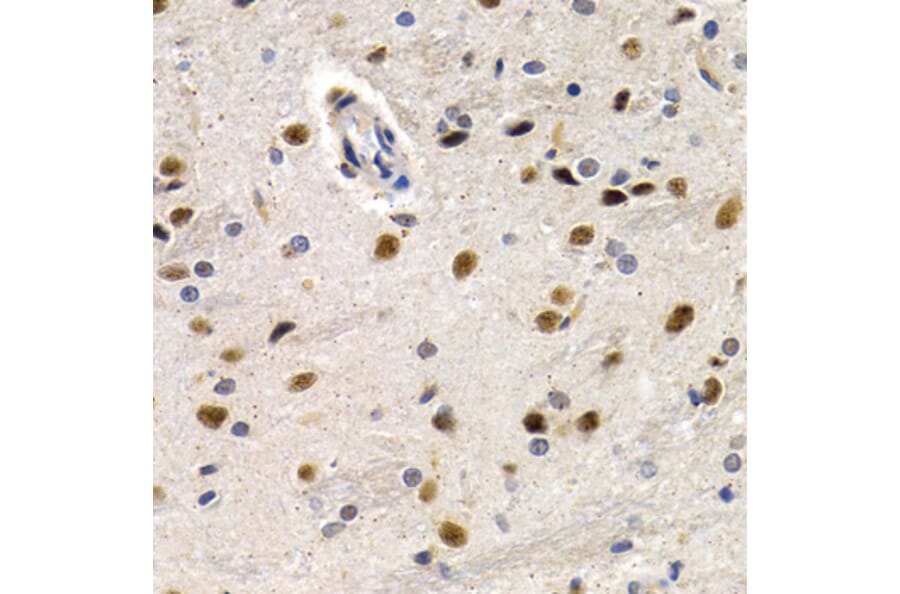 Immunohistochemistry - ID3 antibody from Signalway Antibody (38647) - Antibodies.com