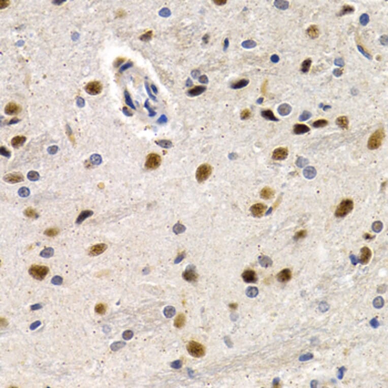 Immunohistochemistry - ID3 antibody from Signalway Antibody (38647) - Antibodies.com