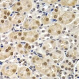 Immunohistochemistry - ID3 antibody from Signalway Antibody (38647) - Antibodies.com