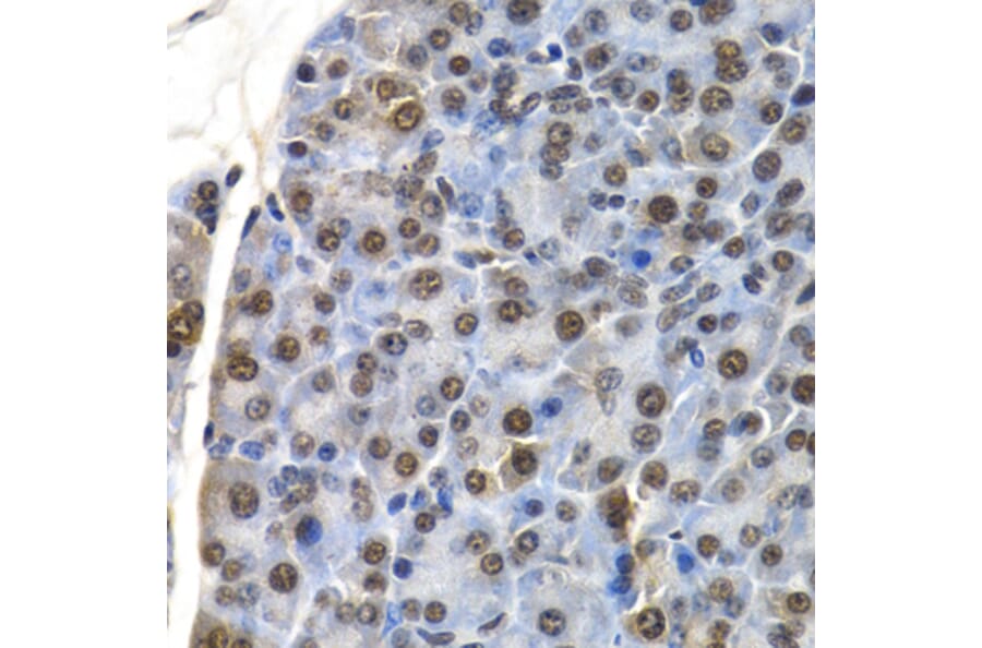 Immunohistochemistry - ID3 antibody from Signalway Antibody (38647) - Antibodies.com