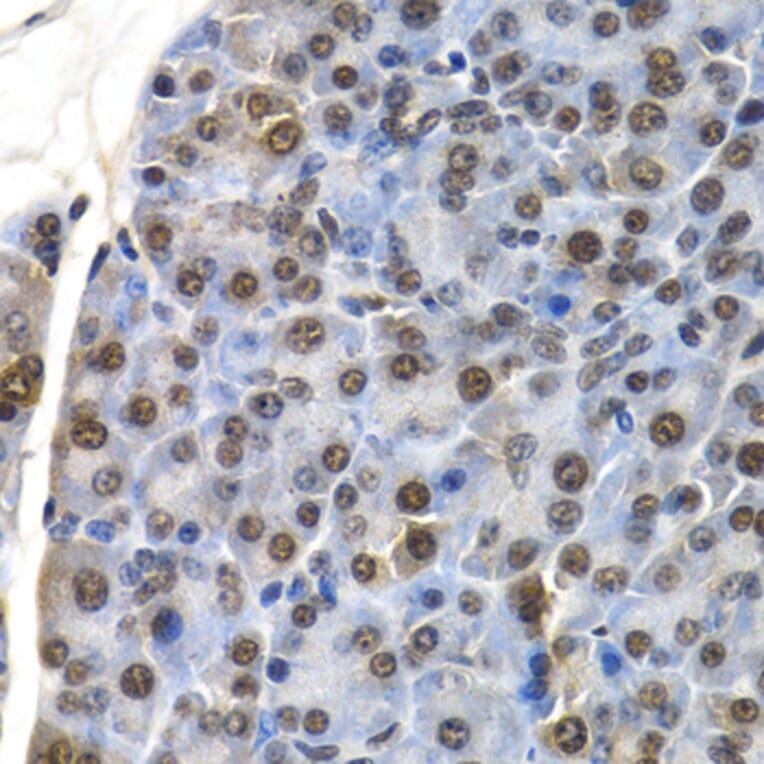 Immunohistochemistry - ID3 antibody from Signalway Antibody (38647) - Antibodies.com